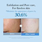 MEDICUBE — Zero Pore Toner
