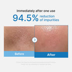 MEDICUBE — Zero Pore Blackhead Deep Cleansing Oil