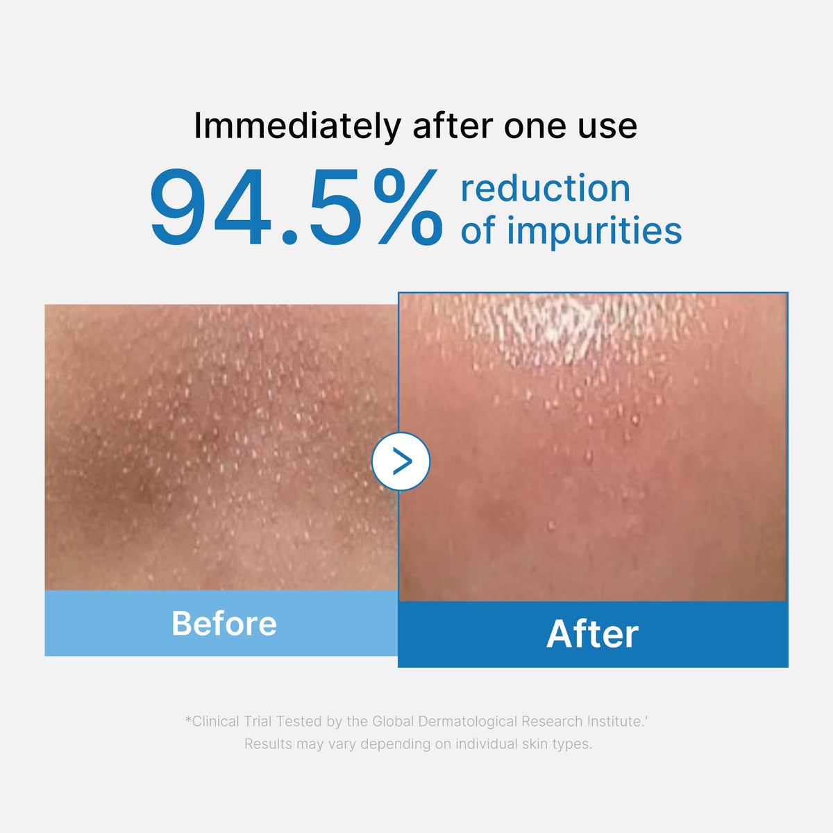 MEDICUBE — Zero Pore Blackhead Deep Cleansing Oil