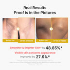 MEDICUBE — Kojic Acid Turmeric Body Peel Shot
