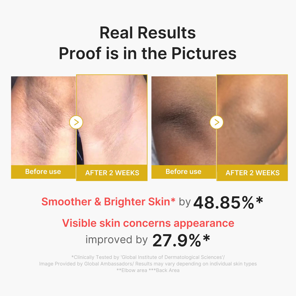 MEDICUBE — Kojic Acid Turmeric Body Peel Shot