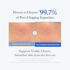 MEDICUBE — Zero Pore Capsule Cleansing Foam