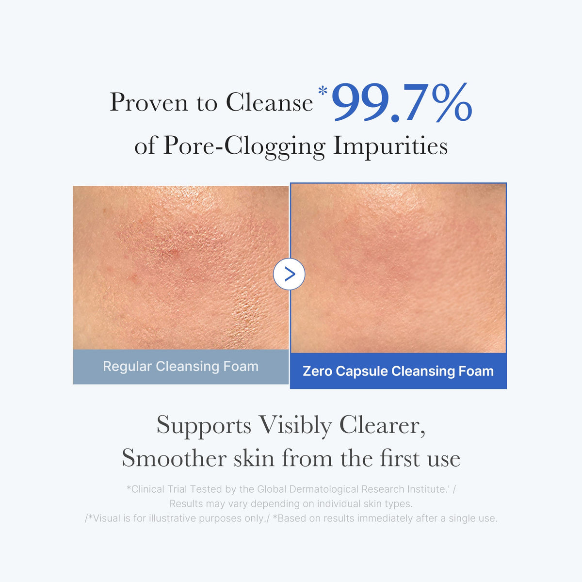 MEDICUBE — Zero Pore Capsule Cleansing Foam