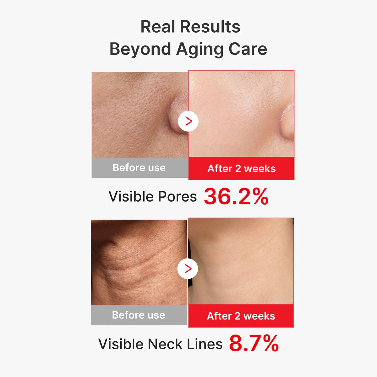 MEDICUBE — 7-Day Anti-Aging & Plump Set