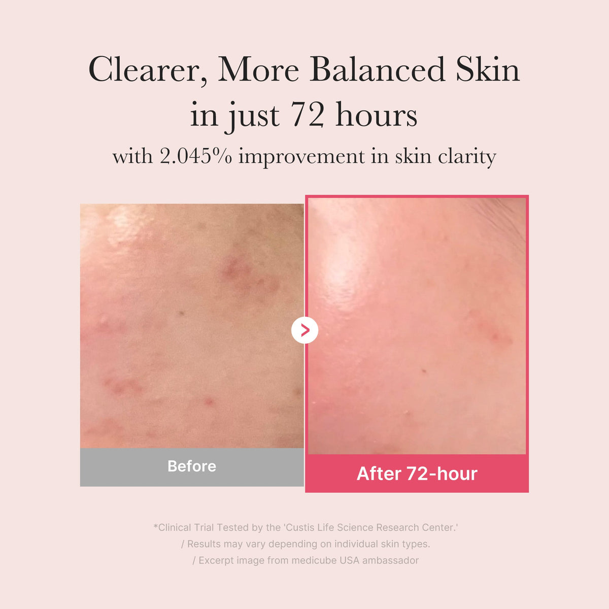 MEDICUBE — TXA Niacinamide Serum